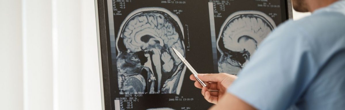 A doctor looking at brain scans.